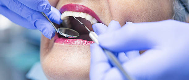 Best Knocked-Out Tooth (Avulsed Tooth) Treatment in Hailey, ID